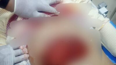 Tragis !! Seorang Kakak Bunuh Adik Kandung, Ini Motifnya