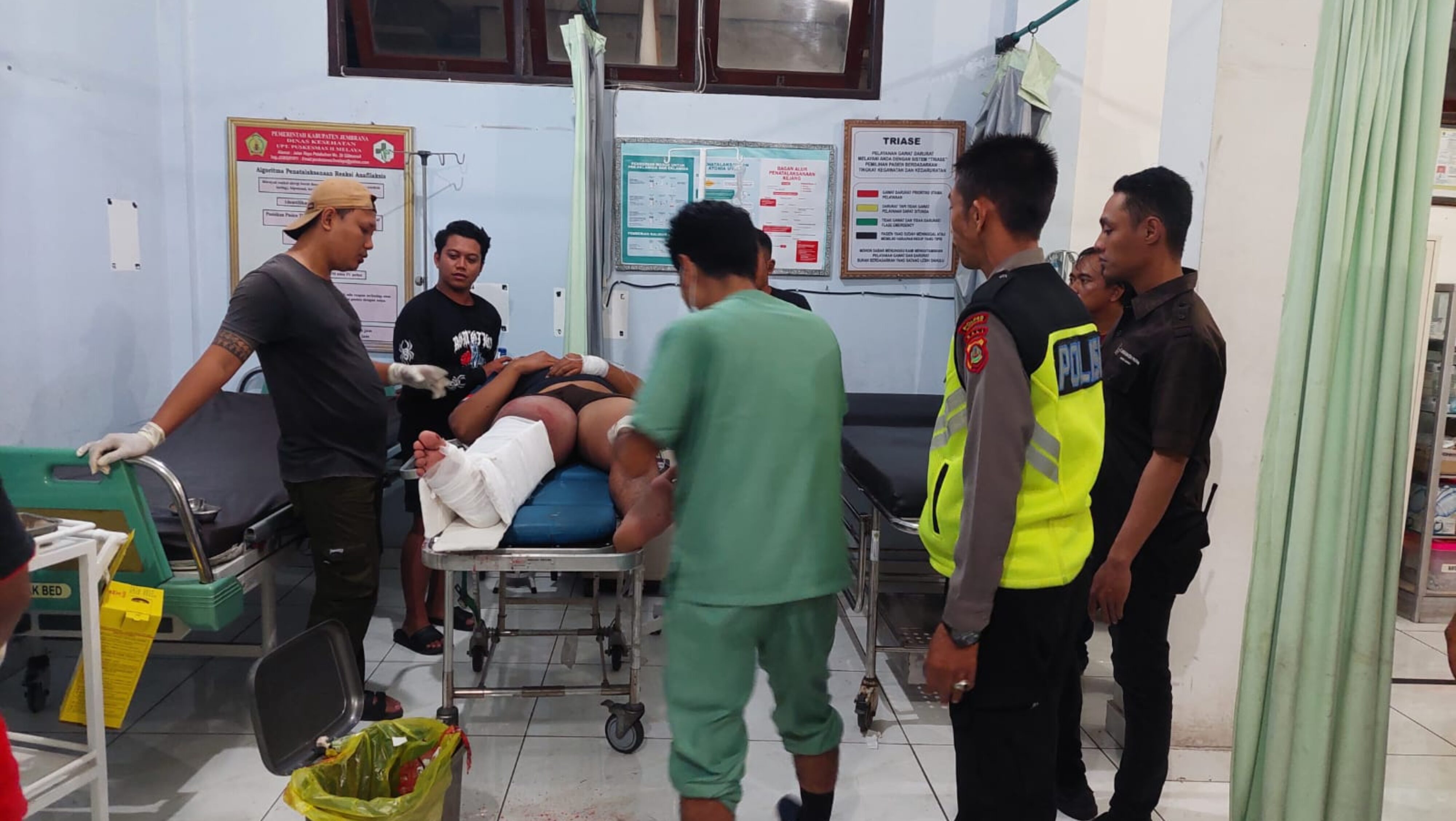 Terlindas Bus Pariwisata di Pelabuhan Gilimanuk, Kaki Karyawan Kapal Patah