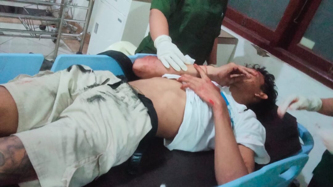 Ngeri! Tabrak Lari di Jembrana, Pemotor Mabuk Terpental ke Kolong Bus