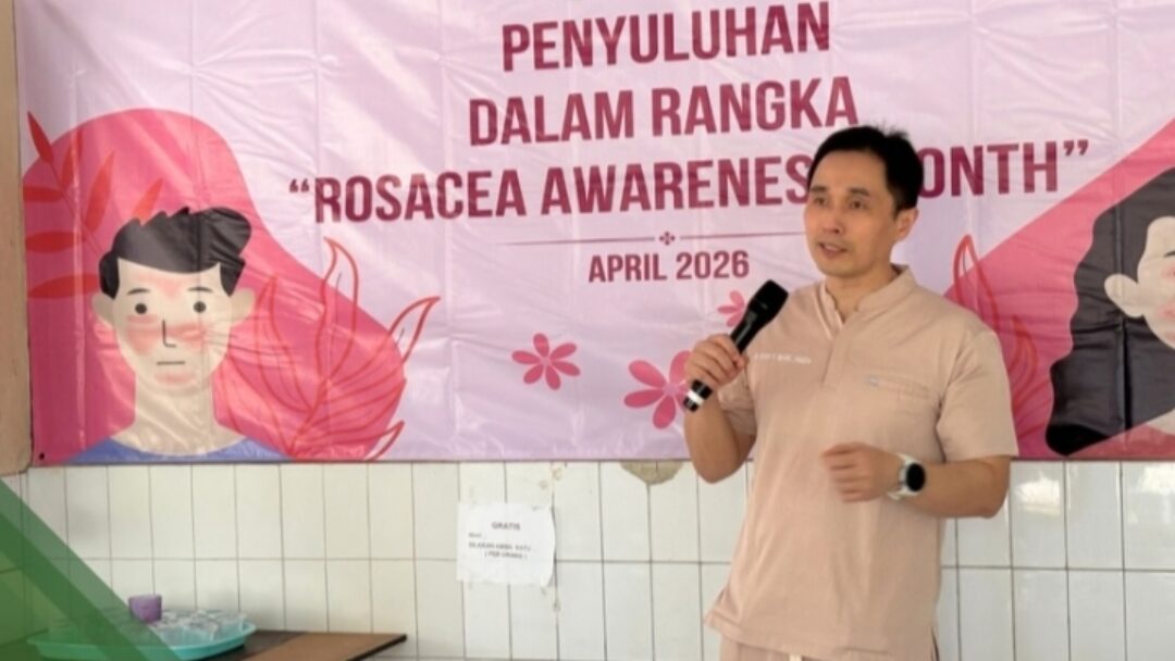 RSUD Magetan Gencarkan Edukasi Rosacea, Masyarakat Diminta Lebih Waspada