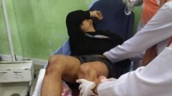 Sepekan Kasus Anak Jurnalis Cirebon Diduga Dianiaya, Keluarga: Pelaku Belum Ditangkap